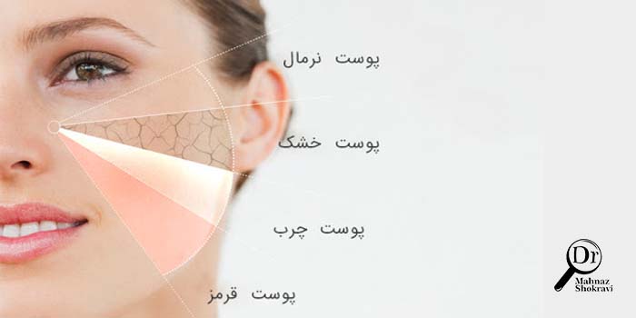 نوع پوست من چیست؟