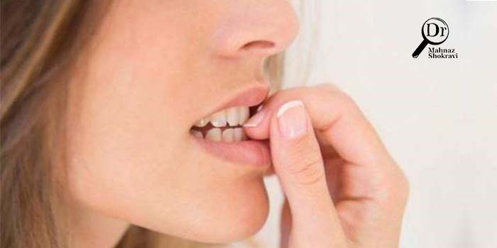6 راهکار برای جلوگیری از جویدن ناخن ها