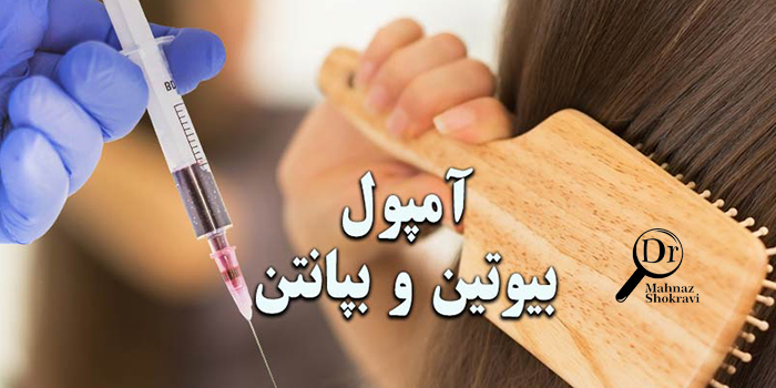 تزریق آمپول بیوتن و ب پنتن برای کنترل ریزش مو