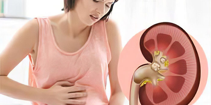 عفونت کلیه چیست و چگونه درمان می شود؟