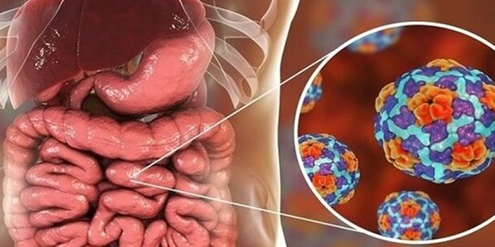 نوروویروس چیست و چگونه درمان می شود؟