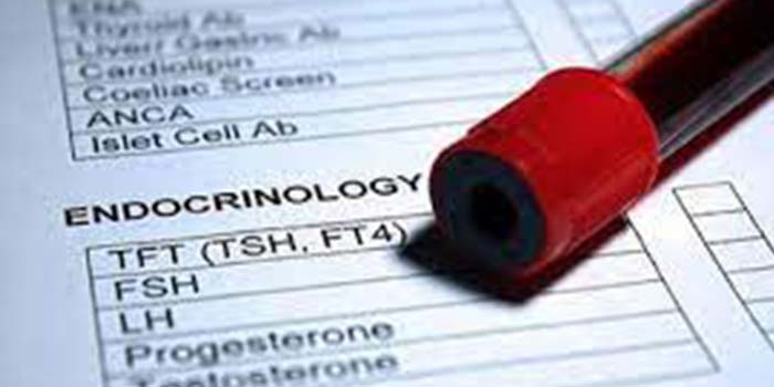 آزمایش FSH چیست و برای چه مواردی استفاده می شود؟