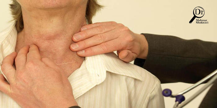 کم کاری تیروئید چیست و چه علائم و عوارضی دارد؟