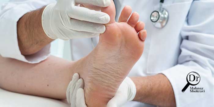 نوروپاتی دیابتی چیست و چگونه درمان می شود؟